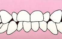 歯並びイメージ